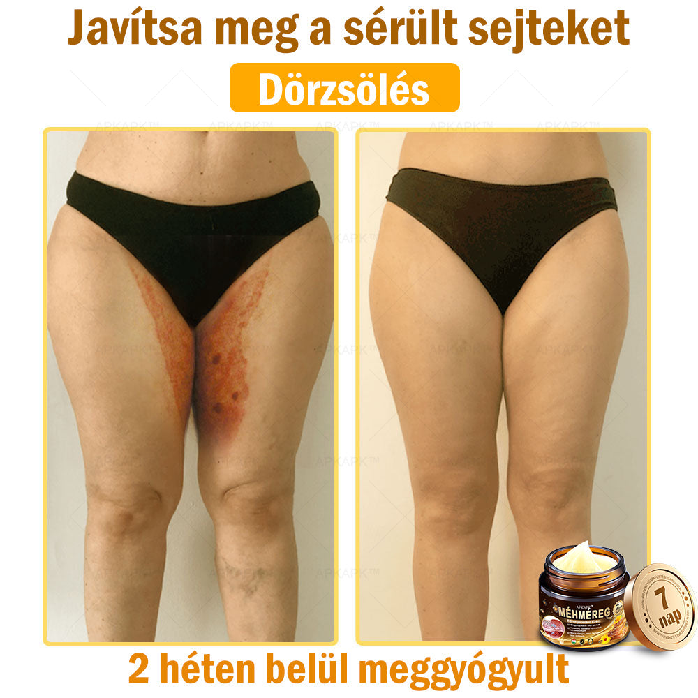 🔥🔥Már csak 5 doboz maradt! További 50% kedvezményt adunk! Tedd egészségesebbé a tested! Ha most lemaradsz róla, akkor csak jövőre kapod meg-APKAPK