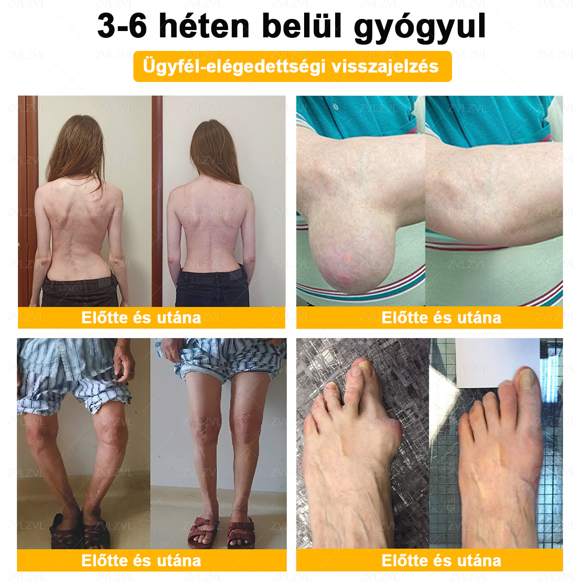 ZVLZVL™ Botulinum Toxin és Méhméreg Fájdalomcsillapító Csontgyógyító Krém ✨🌸(Speziell für ältere Erwachsene & von der EFORT empfohlen)