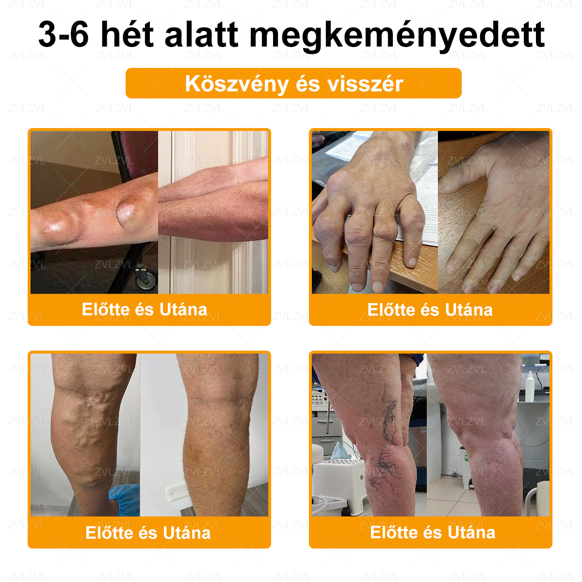 ZVLZVL™ Botulinum Toxin és Méhméreg Fájdalomcsillapító Csontgyógyító Krém ✨🌸(Speziell für ältere Erwachsene & von der EFORT empfohlen)