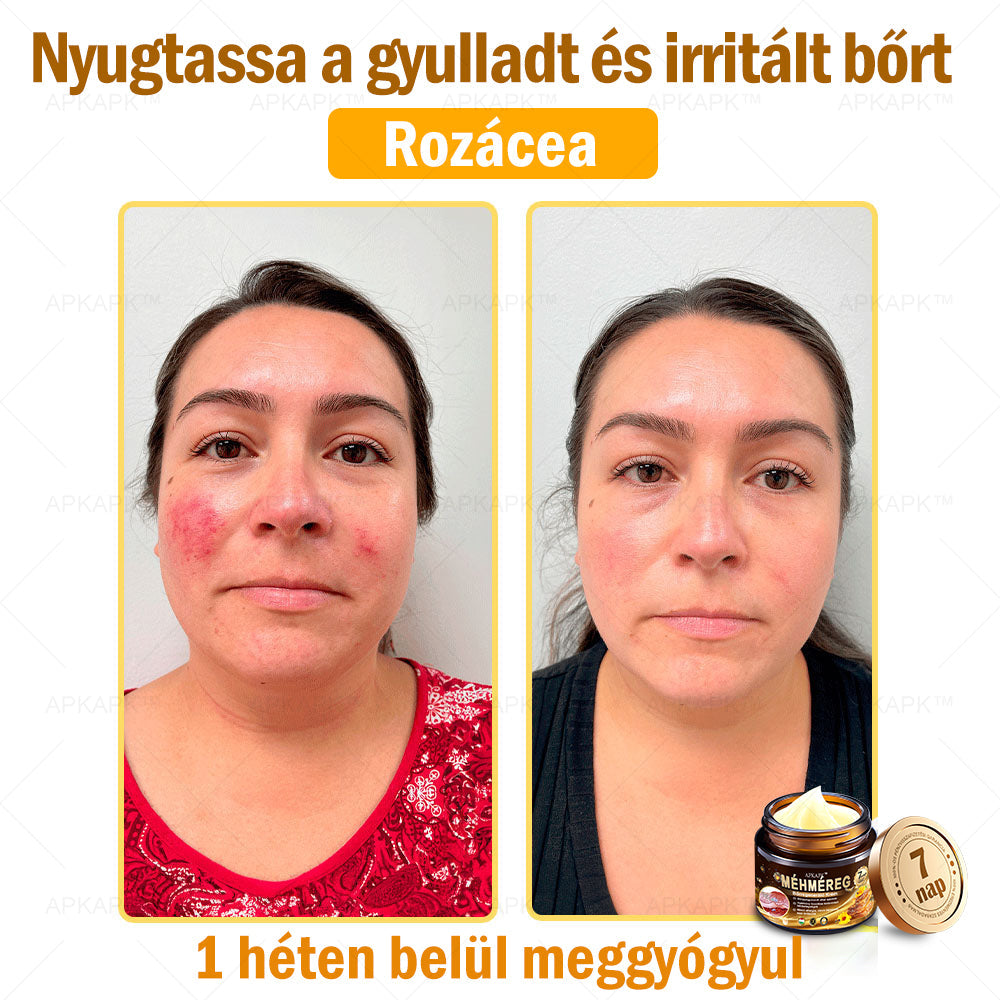 🔥🔥Már csak 5 doboz maradt! További 50% kedvezményt adunk! Tedd egészségesebbé a tested! Ha most lemaradsz róla, akkor csak jövőre kapod meg-APKAPK