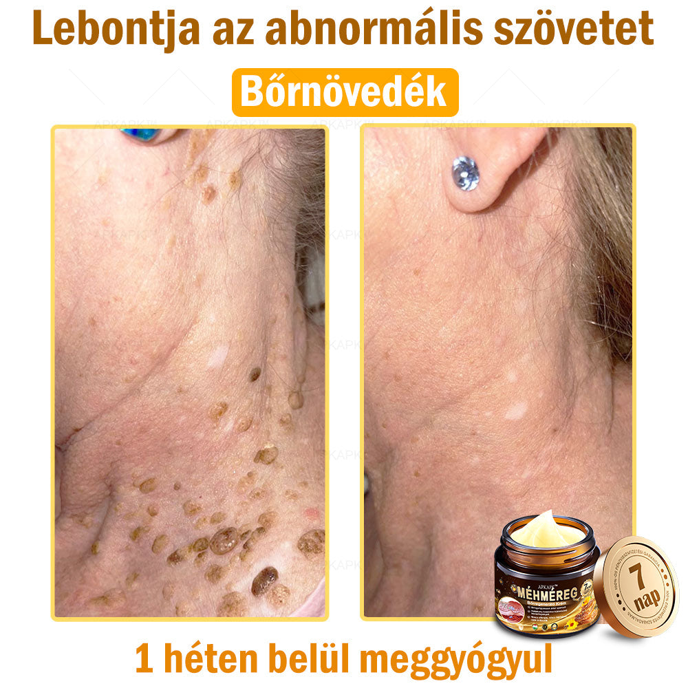 🔥🔥Már csak 5 doboz maradt! További 50% kedvezményt adunk! Tedd egészségesebbé a tested! Ha most lemaradsz róla, akkor csak jövőre kapod meg-APKAPK