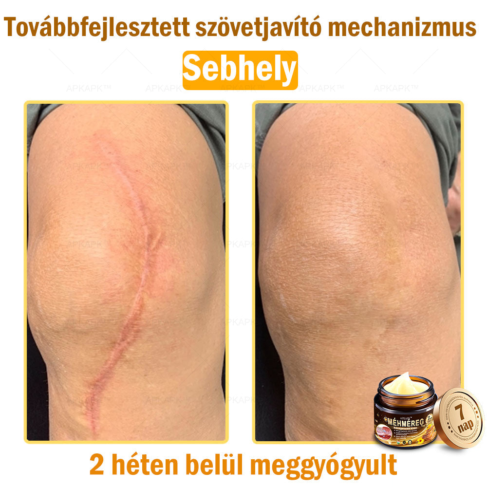🔥🔥Már csak 5 doboz maradt! További 50% kedvezményt adunk! Tedd egészségesebbé a tested! Ha most lemaradsz róla, akkor csak jövőre kapod meg-APKAPK