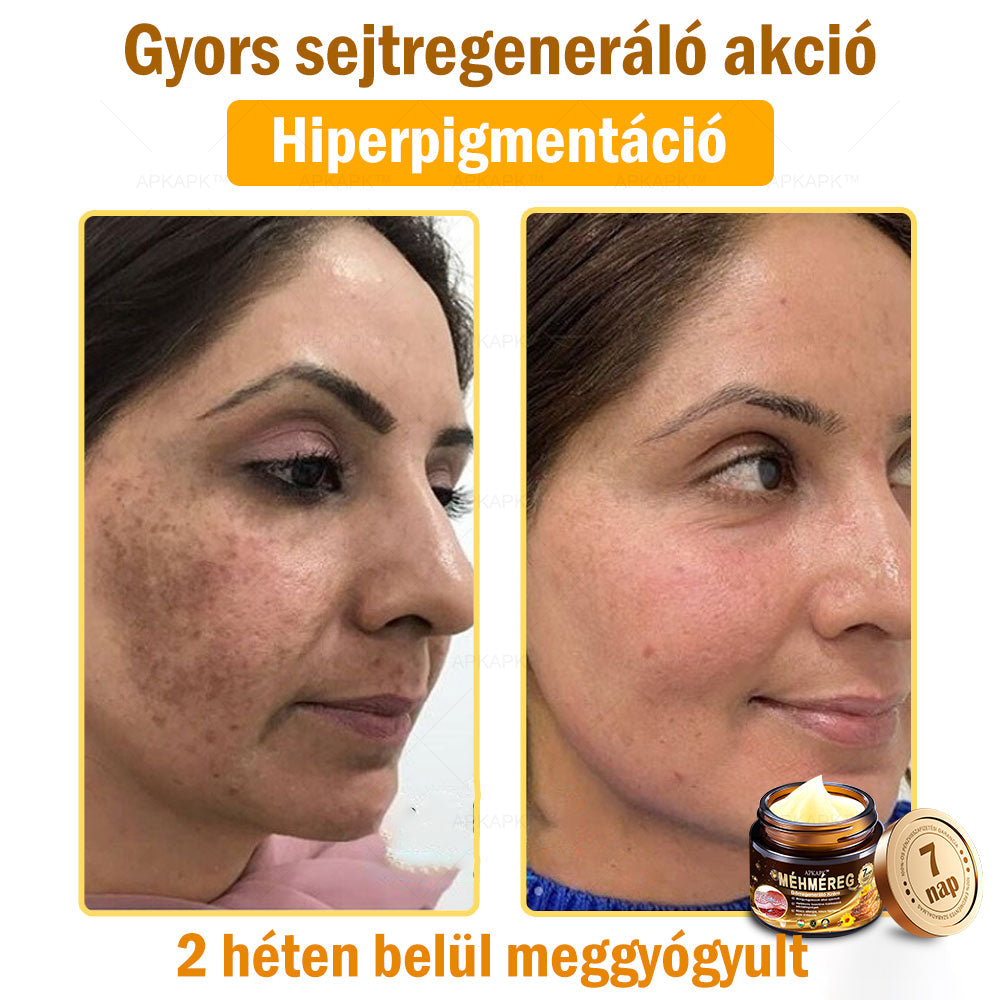 🔥🔥Már csak 5 doboz maradt! További 50% kedvezményt adunk! Tedd egészségesebbé a tested! Ha most lemaradsz róla, akkor csak jövőre kapod meg-APKAPK