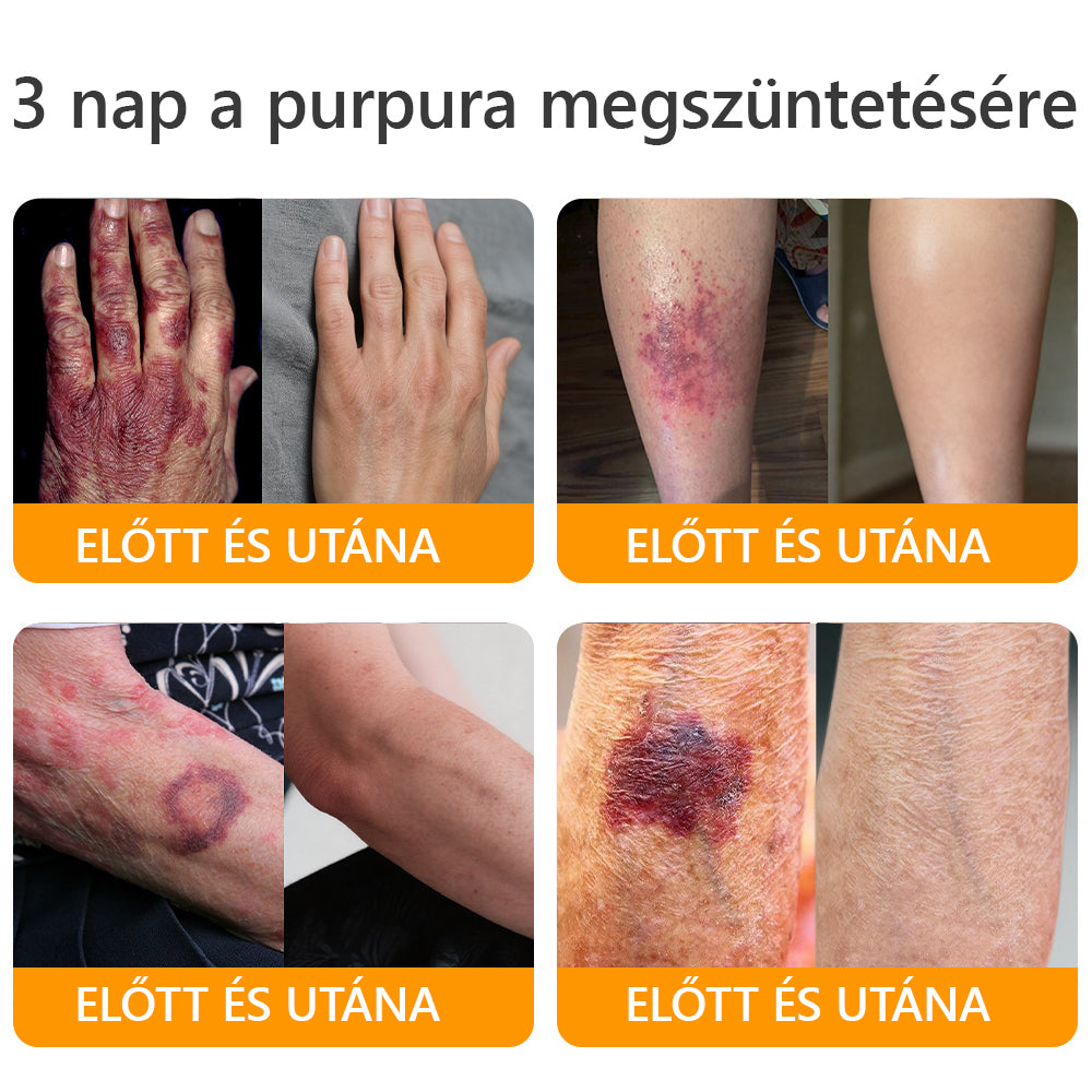 🔥 Már csak 5 doboz maradt! További 50% kedvezményt adunk! Ha most lemaradsz, csak jövőre kaphatod meg - APKAPK