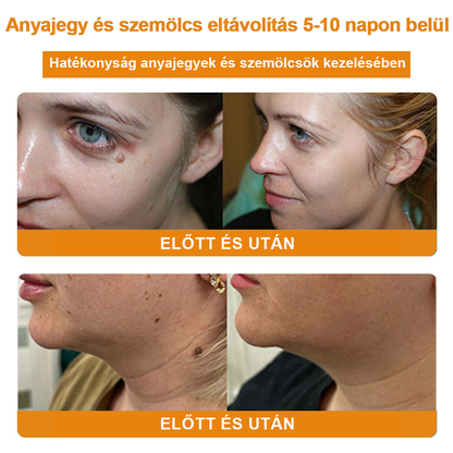 🎁 🍃🎁Már csak 5 doboz maradt! További 50% kedvezményt adunk! Tedd egészségesebbé a tested! Ha most lemaradsz róla, akkor csak jövőre kapod meg.