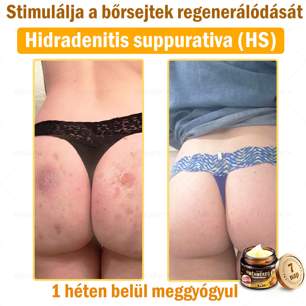 🔥🔥Már csak 5 doboz maradt! További 50% kedvezményt adunk! Tedd egészségesebbé a tested! Ha most lemaradsz róla, akkor csak jövőre kapod meg-APKAPK