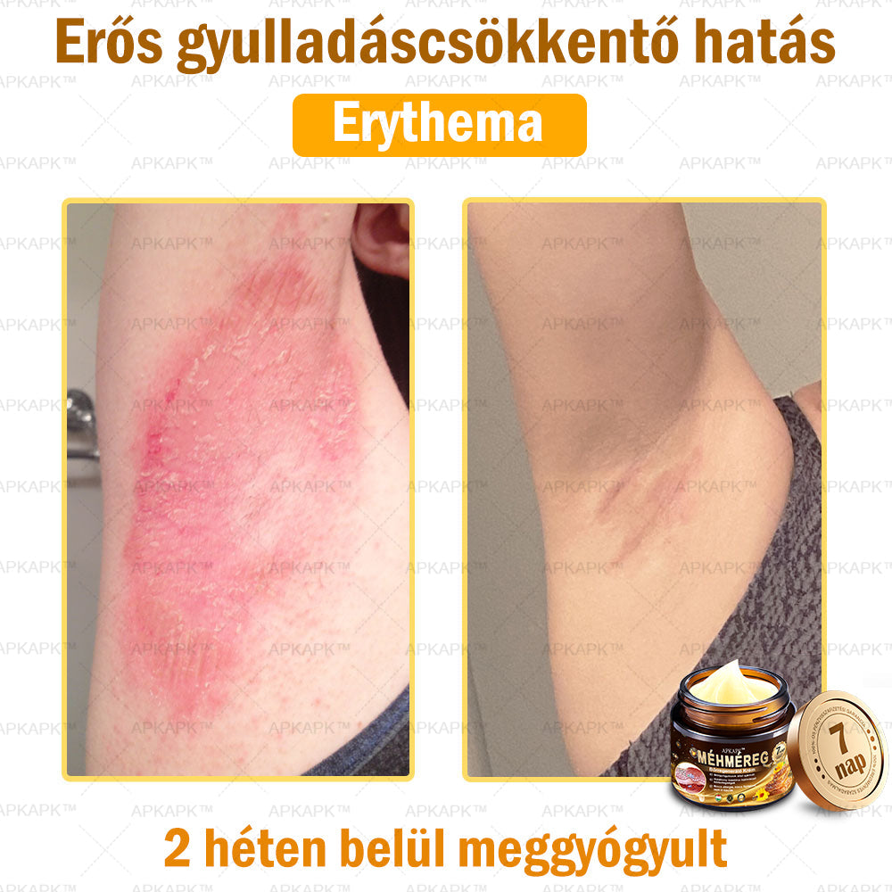 🔥🔥Már csak 5 doboz maradt! További 50% kedvezményt adunk! Tedd egészségesebbé a tested! Ha most lemaradsz róla, akkor csak jövőre kapod meg-APKAPK