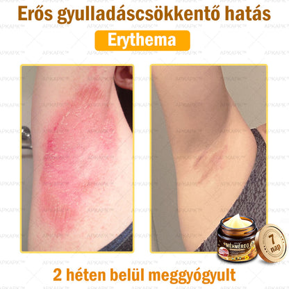 🔥🔥Már csak 5 doboz maradt! További 50% kedvezményt adunk! Tedd egészségesebbé a tested! Ha most lemaradsz róla, akkor csak jövőre kapod meg-APKAPK