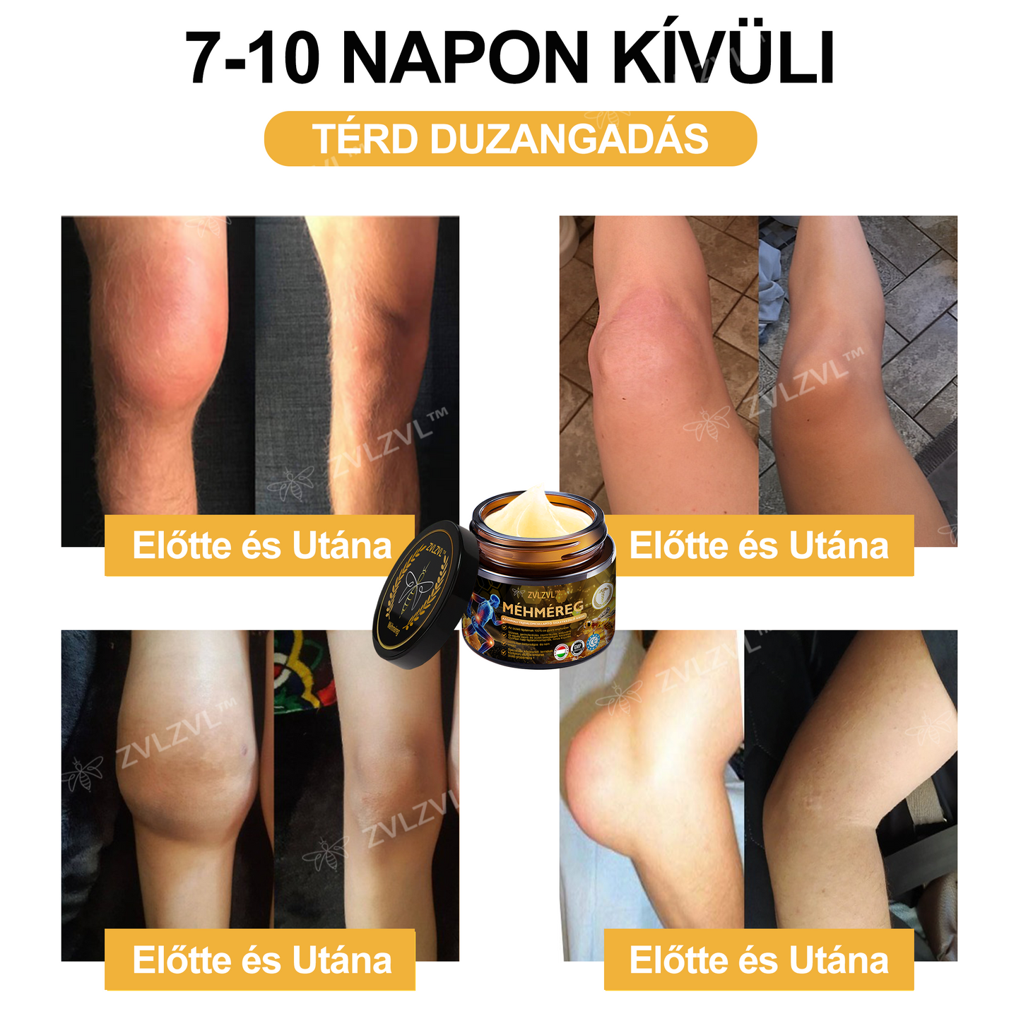 ZVLZVL™🐝Méhméreg Azonnali Ultra Erős Fájdalomcsillapító Krém -❄ Új téli akció | ❄ Akár 70% kedvezmény