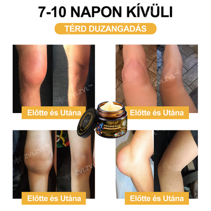 ZVLZVL™🐝Méhméreg Azonnali Ultra Erős Fájdalomcsillapító Krém -❄ Új téli akció | ❄ Akár 70% kedvezmény