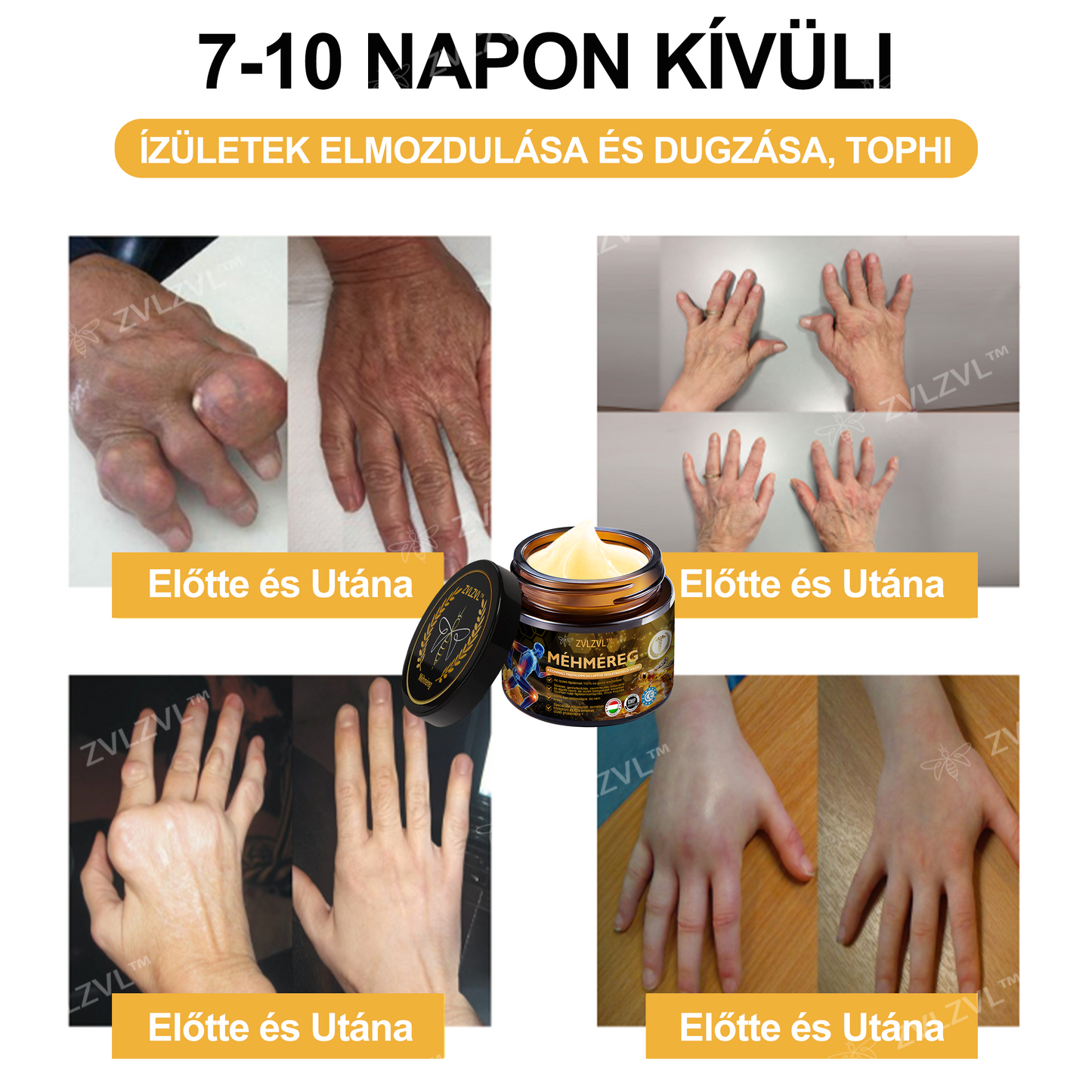 ZVLZVL™🐝Méhméreg Azonnali Ultra Erős Fájdalomcsillapító Krém -❄ Új téli akció | ❄ Akár 70% kedvezmény