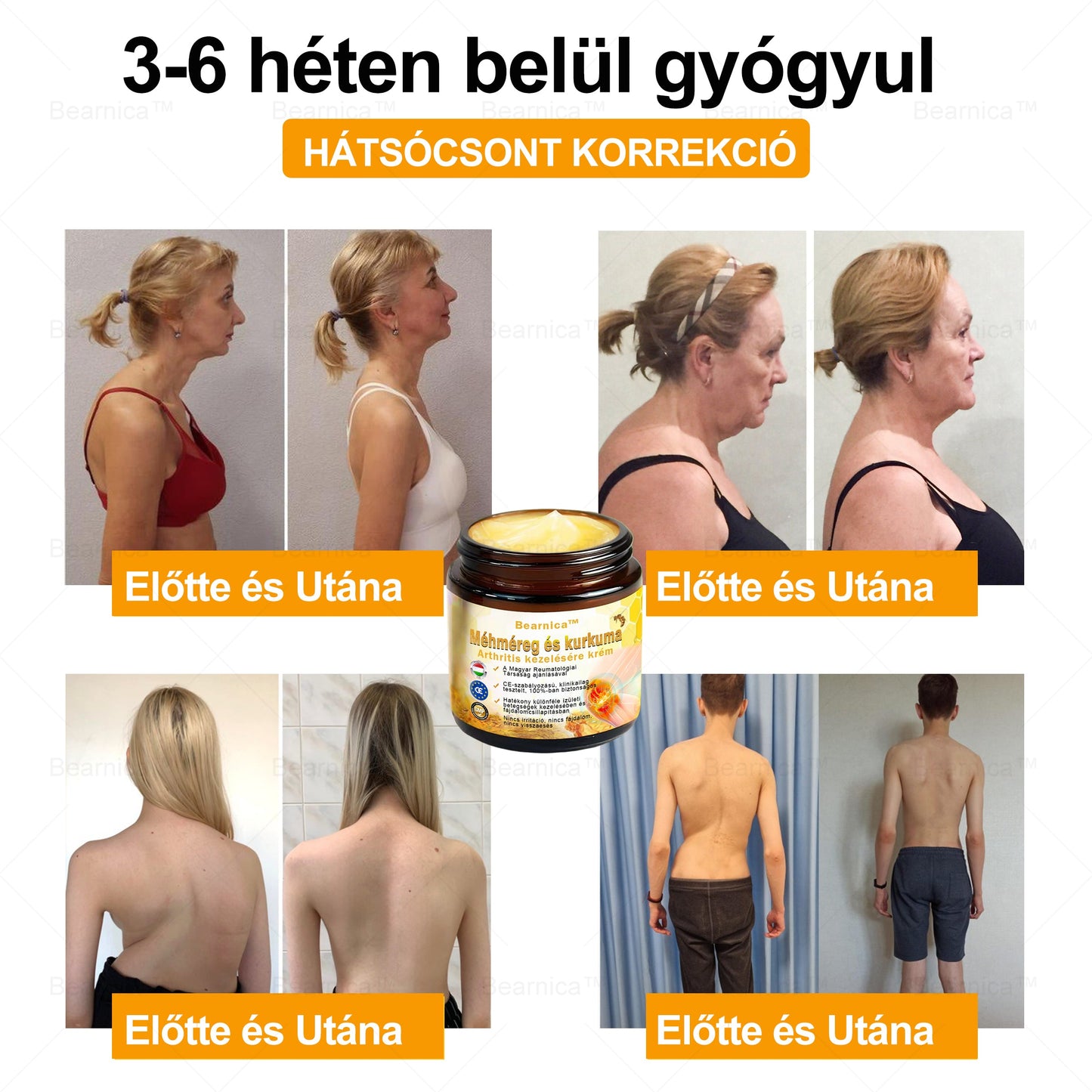 𝐁𝐞𝐚𝐫𝐧𝐢𝐜𝐚™ 🔥🔥🔥 𝐌é𝐡𝐦é𝐫𝐞𝐠- é𝐬 𝐊𝐮𝐫𝐤𝐮𝐦𝐚-𝐀𝐫𝐭𝐡𝐫𝐢𝐭𝐢𝐬 𝐓𝐞𝐫á𝐩𝐢á𝐬 𝐊𝐫é𝐦 (👩‍🔬𝐒𝐩𝐞𝐜𝐢𝐚𝐥𝐢𝐳á𝐥ó𝐝𝐨𝐭𝐭 𝐨𝐫𝐭𝐨𝐩é𝐝𝐢𝐚𝐢 𝐛𝐞𝐭𝐞𝐠𝐬é𝐠𝐞𝐤𝐫𝐞 é𝐬 í𝐳ü𝐥𝐞𝐭𝐢 𝐟á𝐣𝐝𝐚𝐥𝐦𝐚𝐤𝐫𝐚👩‍🔬)