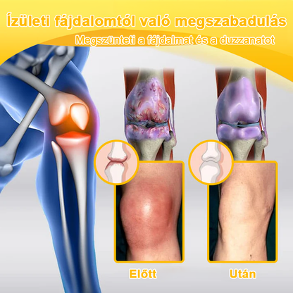 🌿🍯🌿BEARNICA™ Bee Venom Advanced ízület- és csontkezelő krém🔥 (Utolsó napi akció, 70% kedvezmény)