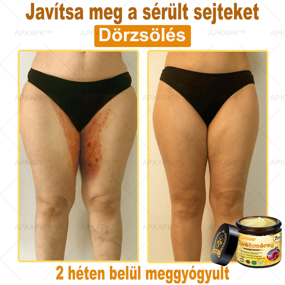 🔥🔥🔥𝐀𝐏𝐊𝐀𝐏𝐊™ 𝐌É𝐇𝐌É𝐑𝐄𝐆 Á𝐓𝐅𝐎𝐆Ó 𝐊𝐑É𝐌🥇𝐀 𝐛ö𝐫𝐩𝐫𝐨𝐛𝐥é𝐦á𝐤 𝐤𝐞𝐳𝐞𝐥é𝐬𝐞 𝐦𝐚𝐠á𝐛𝐚𝐧 𝐟𝐨𝐠𝐥𝐚𝐥𝐣𝐚: é𝐥𝐞𝐭𝐤𝐨𝐫𝐢 𝐟𝐨𝐥𝐭𝐨𝐤, 𝐡𝐞𝐠𝐞𝐤, 𝐬𝐳𝐞𝐦ö𝐥𝐜𝐬ö𝐤, 𝐛ö𝐫𝐧ö𝐯𝐞𝐝é𝐤𝐞𝐤, 𝐭á𝐥𝐲𝐨𝐠𝐨𝐤, 𝐩𝐚𝐭𝐭𝐚𝐧á𝐬𝐨𝐤, 𝐞𝐤𝐜é𝐦𝐚, 𝐩𝐬𝐨𝐫𝐢𝐚𝐬𝐢𝐬, 𝐚𝐜𝐧𝐞 𝐢𝐧𝐯𝐞𝐫𝐬𝐚, 𝐫á𝐧𝐜𝐨𝐤, 𝐛ö𝐫ö𝐫𝐞𝐠𝐞𝐝é𝐬 é𝐬 𝐞𝐠𝐲é𝐛 𝐩𝐫𝐨𝐛𝐥é𝐦á𝐤🔥