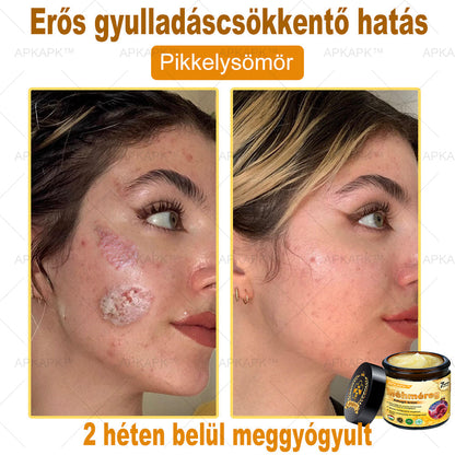 🔥🔥🔥𝐀𝐏𝐊𝐀𝐏𝐊™ 𝐌É𝐇𝐌É𝐑𝐄𝐆 Á𝐓𝐅𝐎𝐆Ó 𝐊𝐑É𝐌🥇𝐀 𝐛ö𝐫𝐩𝐫𝐨𝐛𝐥é𝐦á𝐤 𝐤𝐞𝐳𝐞𝐥é𝐬𝐞 𝐦𝐚𝐠á𝐛𝐚𝐧 𝐟𝐨𝐠𝐥𝐚𝐥𝐣𝐚: é𝐥𝐞𝐭𝐤𝐨𝐫𝐢 𝐟𝐨𝐥𝐭𝐨𝐤, 𝐡𝐞𝐠𝐞𝐤, 𝐬𝐳𝐞𝐦ö𝐥𝐜𝐬ö𝐤, 𝐛ö𝐫𝐧ö𝐯𝐞𝐝é𝐤𝐞𝐤, 𝐭á𝐥𝐲𝐨𝐠𝐨𝐤, 𝐩𝐚𝐭𝐭𝐚𝐧á𝐬𝐨𝐤, 𝐞𝐤𝐜é𝐦𝐚, 𝐩𝐬𝐨𝐫𝐢𝐚𝐬𝐢𝐬, 𝐚𝐜𝐧𝐞 𝐢𝐧𝐯𝐞𝐫𝐬𝐚, 𝐫á𝐧𝐜𝐨𝐤, 𝐛ö𝐫ö𝐫𝐞𝐠𝐞𝐝é𝐬 é𝐬 𝐞𝐠𝐲é𝐛 𝐩𝐫𝐨𝐛𝐥é𝐦á𝐤🔥