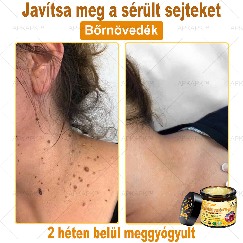 🔥🔥🔥𝐀𝐏𝐊𝐀𝐏𝐊™ 𝐌É𝐇𝐌É𝐑𝐄𝐆 Á𝐓𝐅𝐎𝐆Ó 𝐊𝐑É𝐌🥇𝐀 𝐛ö𝐫𝐩𝐫𝐨𝐛𝐥é𝐦á𝐤 𝐤𝐞𝐳𝐞𝐥é𝐬𝐞 𝐦𝐚𝐠á𝐛𝐚𝐧 𝐟𝐨𝐠𝐥𝐚𝐥𝐣𝐚: é𝐥𝐞𝐭𝐤𝐨𝐫𝐢 𝐟𝐨𝐥𝐭𝐨𝐤, 𝐡𝐞𝐠𝐞𝐤, 𝐬𝐳𝐞𝐦ö𝐥𝐜𝐬ö𝐤, 𝐛ö𝐫𝐧ö𝐯𝐞𝐝é𝐤𝐞𝐤, 𝐭á𝐥𝐲𝐨𝐠𝐨𝐤, 𝐩𝐚𝐭𝐭𝐚𝐧á𝐬𝐨𝐤, 𝐞𝐤𝐜é𝐦𝐚, 𝐩𝐬𝐨𝐫𝐢𝐚𝐬𝐢𝐬, 𝐚𝐜𝐧𝐞 𝐢𝐧𝐯𝐞𝐫𝐬𝐚, 𝐫á𝐧𝐜𝐨𝐤, 𝐛ö𝐫ö𝐫𝐞𝐠𝐞𝐝é𝐬 é𝐬 𝐞𝐠𝐲é𝐛 𝐩𝐫𝐨𝐛𝐥é𝐦á𝐤🔥
