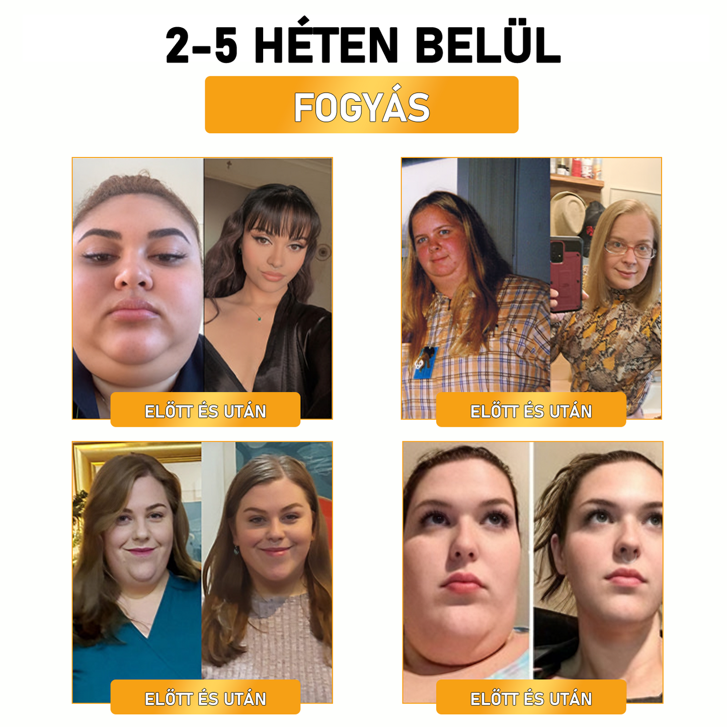 🐝ZVLZVL™ Méhméreg Lymphatic DetoxFogyasztó Tapasz 🔥𝐊𝐨𝐫𝐥á𝐭𝐨𝐳𝐨𝐭𝐭 𝐢𝐝𝐞𝐢𝐠 𝟕𝟎% 𝐊𝐄𝐃𝐕𝐄𝐙𝐌É𝐍𝐘🔥 (Szabadalmazott módszerrel az összes korosztály számára)