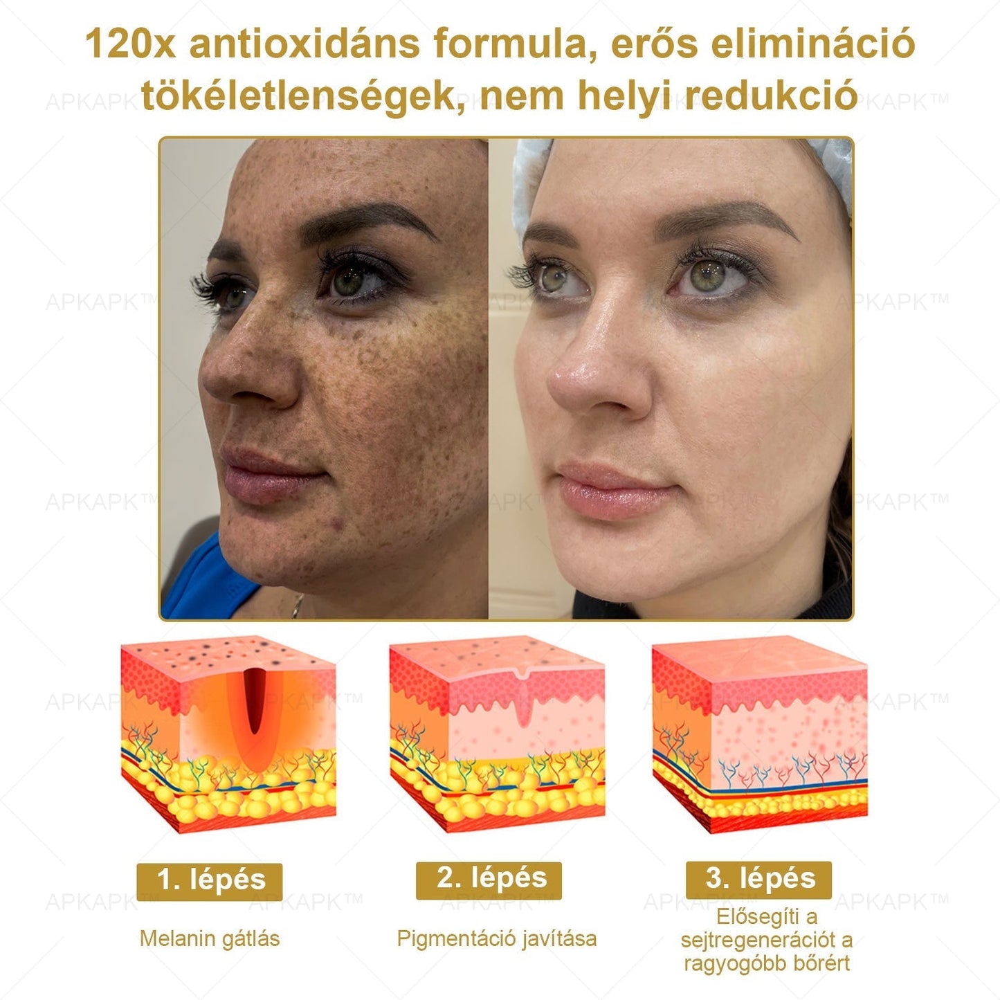 𝐀𝐏𝐊𝐀𝐏𝐊™ 𝐇𝐚𝐭é𝐤𝐨𝐧𝐲, 𝐦𝐢𝐧𝐝𝐞𝐧𝐭 𝐞𝐠𝐲𝐛𝐞𝐧 𝐛ő𝐫á𝐩𝐨𝐥ó 𝐤𝐫é𝐦