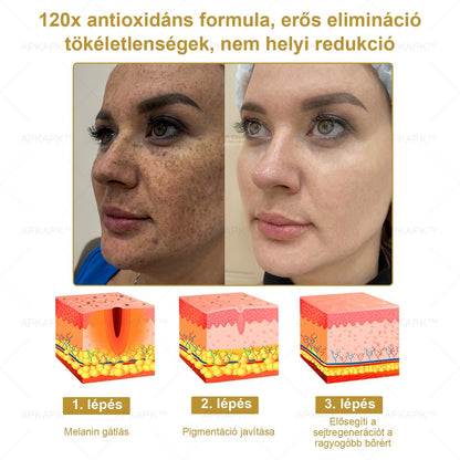 𝐀𝐏𝐊𝐀𝐏𝐊™ 𝐇𝐚𝐭é𝐤𝐨𝐧𝐲, 𝐦𝐢𝐧𝐝𝐞𝐧𝐭 𝐞𝐠𝐲𝐛𝐞𝐧 𝐛ő𝐫á𝐩𝐨𝐥ó 𝐤𝐫é𝐦