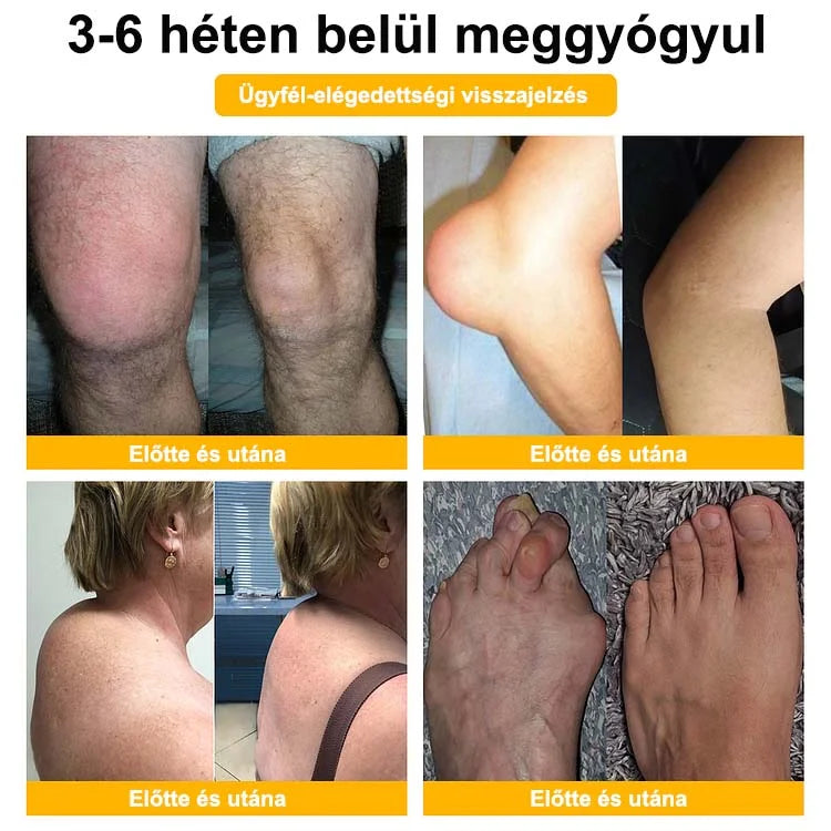 🎁🌿 Már csak 5 doboz maradt! További 50% kedvezményt adunk! Tedd egészségesebbé a tested! Ha most lemaradsz róla, akkor csak jövőre kapod meg