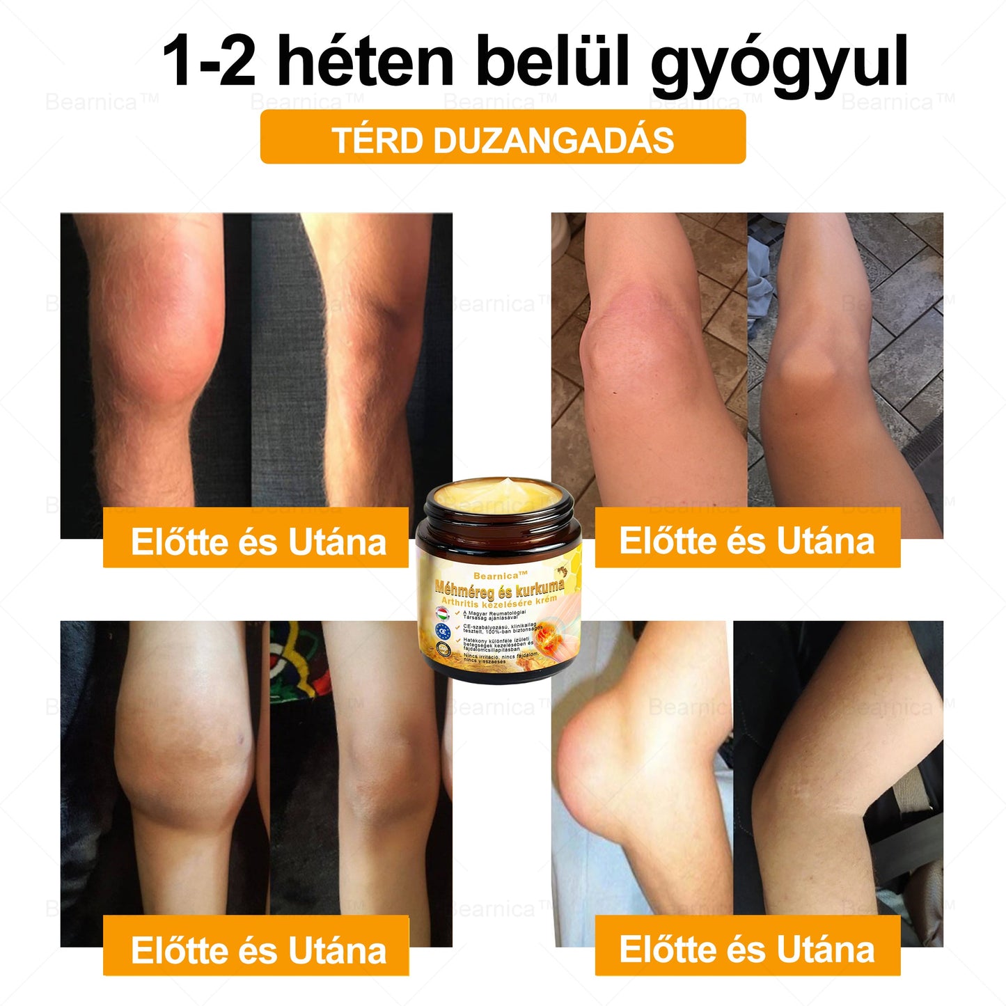 𝐁𝐞𝐚𝐫𝐧𝐢𝐜𝐚™ 🔥🔥🔥 𝐌é𝐡𝐦é𝐫𝐞𝐠- é𝐬 𝐊𝐮𝐫𝐤𝐮𝐦𝐚-𝐀𝐫𝐭𝐡𝐫𝐢𝐭𝐢𝐬 𝐓𝐞𝐫á𝐩𝐢á𝐬 𝐊𝐫é𝐦 (👩‍🔬𝐒𝐩𝐞𝐜𝐢𝐚𝐥𝐢𝐳á𝐥ó𝐝𝐨𝐭𝐭 𝐨𝐫𝐭𝐨𝐩é𝐝𝐢𝐚𝐢 𝐛𝐞𝐭𝐞𝐠𝐬é𝐠𝐞𝐤𝐫𝐞 é𝐬 í𝐳ü𝐥𝐞𝐭𝐢 𝐟á𝐣𝐝𝐚𝐥𝐦𝐚𝐤𝐫𝐚👩‍🔬)