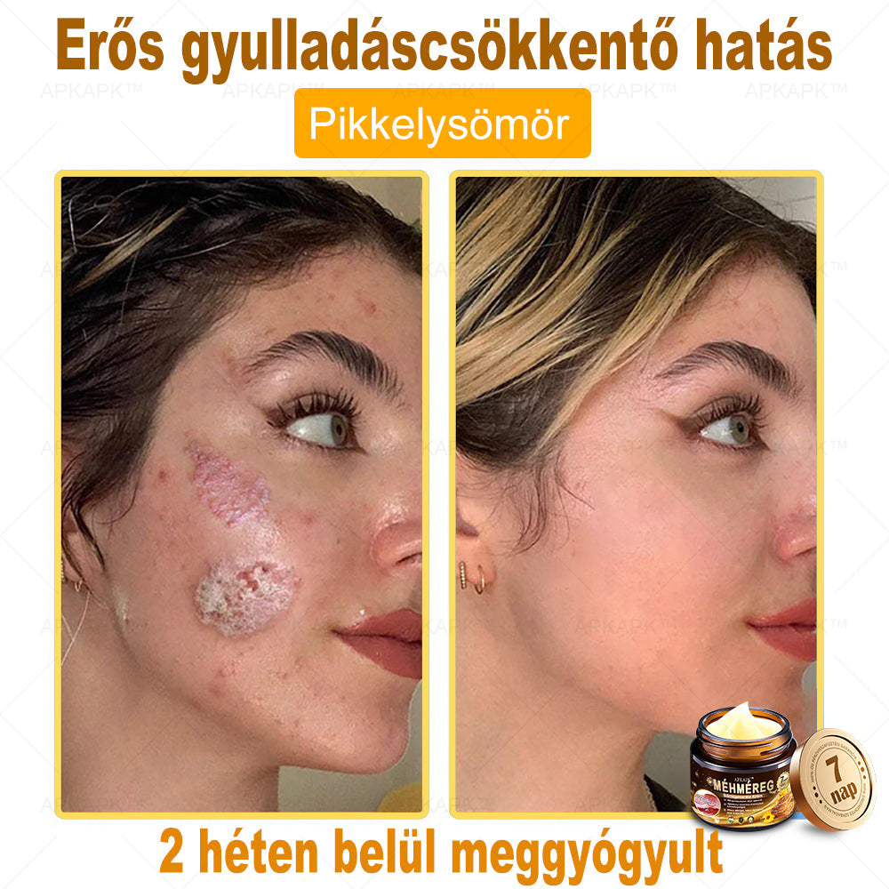 🔥🔥Már csak 5 doboz maradt! További 50% kedvezményt adunk! Tedd egészségesebbé a tested! Ha most lemaradsz róla, akkor csak jövőre kapod meg-APKAPK