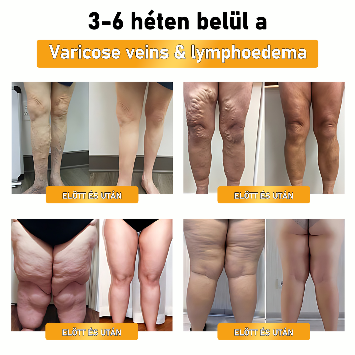 🐝ZVLZVL™ Méhméreg Lymphatic DetoxFogyasztó Tapasz 🔥𝐊𝐨𝐫𝐥á𝐭𝐨𝐳𝐨𝐭𝐭 𝐢𝐝𝐞𝐢𝐠 𝟕𝟎% 𝐊𝐄𝐃𝐕𝐄𝐙𝐌É𝐍𝐘🔥 (Szabadalmazott módszerrel az összes korosztály számára)