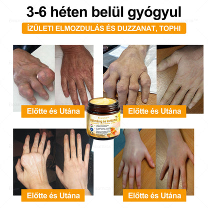 𝐁𝐞𝐚𝐫𝐧𝐢𝐜𝐚™ 🔥🔥🔥 𝐌é𝐡𝐦é𝐫𝐞𝐠- é𝐬 𝐊𝐮𝐫𝐤𝐮𝐦𝐚-𝐀𝐫𝐭𝐡𝐫𝐢𝐭𝐢𝐬 𝐓𝐞𝐫á𝐩𝐢á𝐬 𝐊𝐫é𝐦 (👩‍🔬𝐒𝐩𝐞𝐜𝐢𝐚𝐥𝐢𝐳á𝐥ó𝐝𝐨𝐭𝐭 𝐨𝐫𝐭𝐨𝐩é𝐝𝐢𝐚𝐢 𝐛𝐞𝐭𝐞𝐠𝐬é𝐠𝐞𝐤𝐫𝐞 é𝐬 í𝐳ü𝐥𝐞𝐭𝐢 𝐟á𝐣𝐝𝐚𝐥𝐦𝐚𝐤𝐫𝐚👩‍🔬)