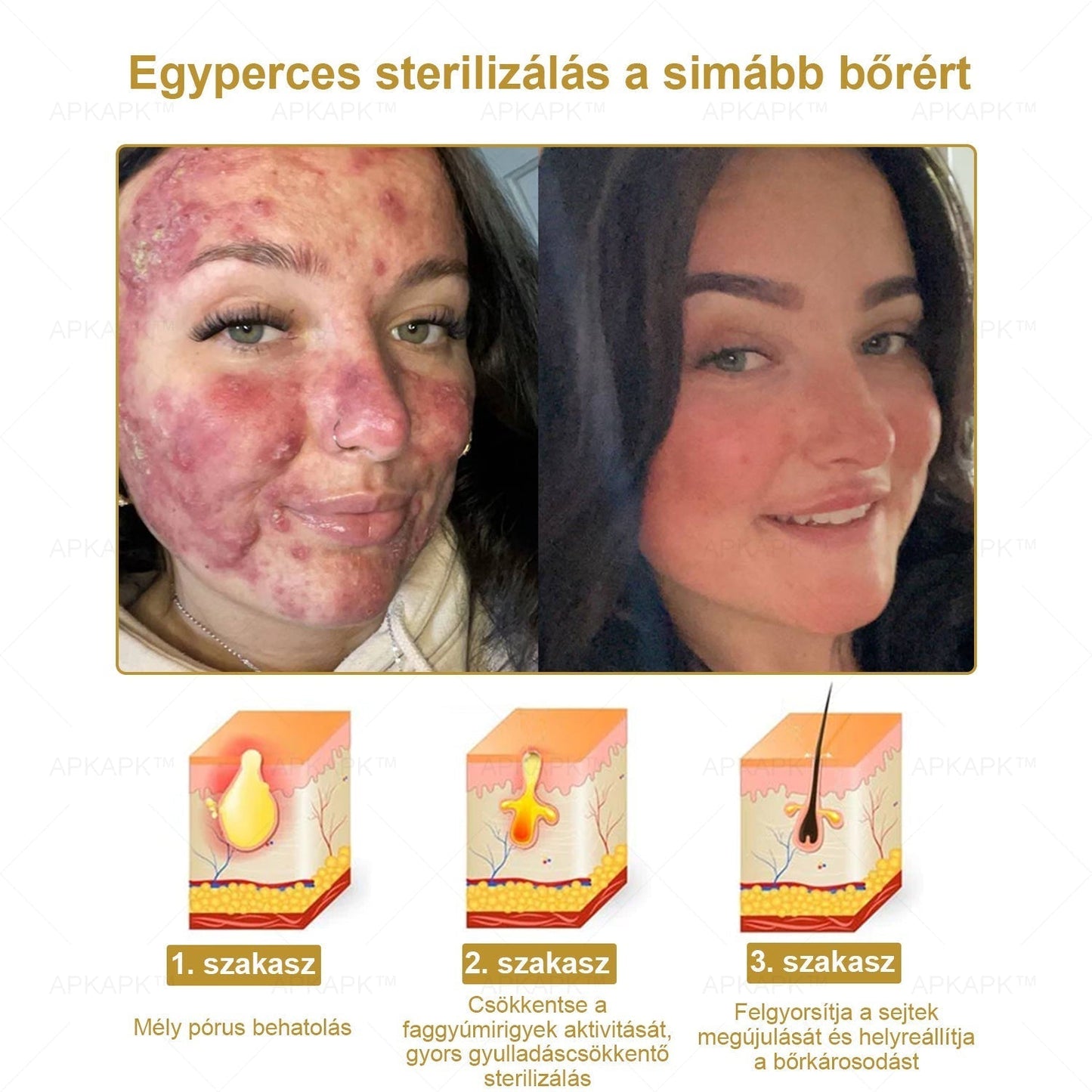 🔥🔥Már csak 5 doboz maradt! További 50% kedvezményt adunk! Tedd egészségesebbé a tested! Ha most lemaradsz róla, akkor csak jövőre kapod meg-APKAPK