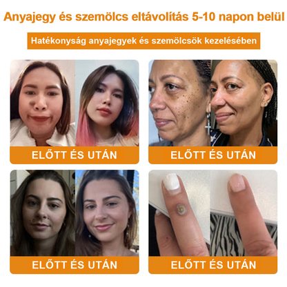 🎁 🍃🎁Már csak 5 doboz maradt! További 50% kedvezményt adunk! Tedd egészségesebbé a tested! Ha most lemaradsz róla, akkor csak jövőre kapod meg.
