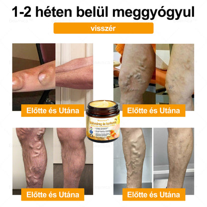𝐁𝐞𝐚𝐫𝐧𝐢𝐜𝐚™ 🔥🔥🔥 𝐌é𝐡𝐦é𝐫𝐞𝐠- é𝐬 𝐊𝐮𝐫𝐤𝐮𝐦𝐚-𝐀𝐫𝐭𝐡𝐫𝐢𝐭𝐢𝐬 𝐓𝐞𝐫á𝐩𝐢á𝐬 𝐊𝐫é𝐦 (👩‍🔬𝐒𝐩𝐞𝐜𝐢𝐚𝐥𝐢𝐳á𝐥ó𝐝𝐨𝐭𝐭 𝐨𝐫𝐭𝐨𝐩é𝐝𝐢𝐚𝐢 𝐛𝐞𝐭𝐞𝐠𝐬é𝐠𝐞𝐤𝐫𝐞 é𝐬 í𝐳ü𝐥𝐞𝐭𝐢 𝐟á𝐣𝐝𝐚𝐥𝐦𝐚𝐤𝐫𝐚👩‍🔬)