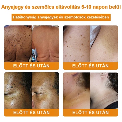 🎁 🍃🎁Már csak 5 doboz maradt! További 50% kedvezményt adunk! Tedd egészségesebbé a tested! Ha most lemaradsz róla, akkor csak jövőre kapod meg.
