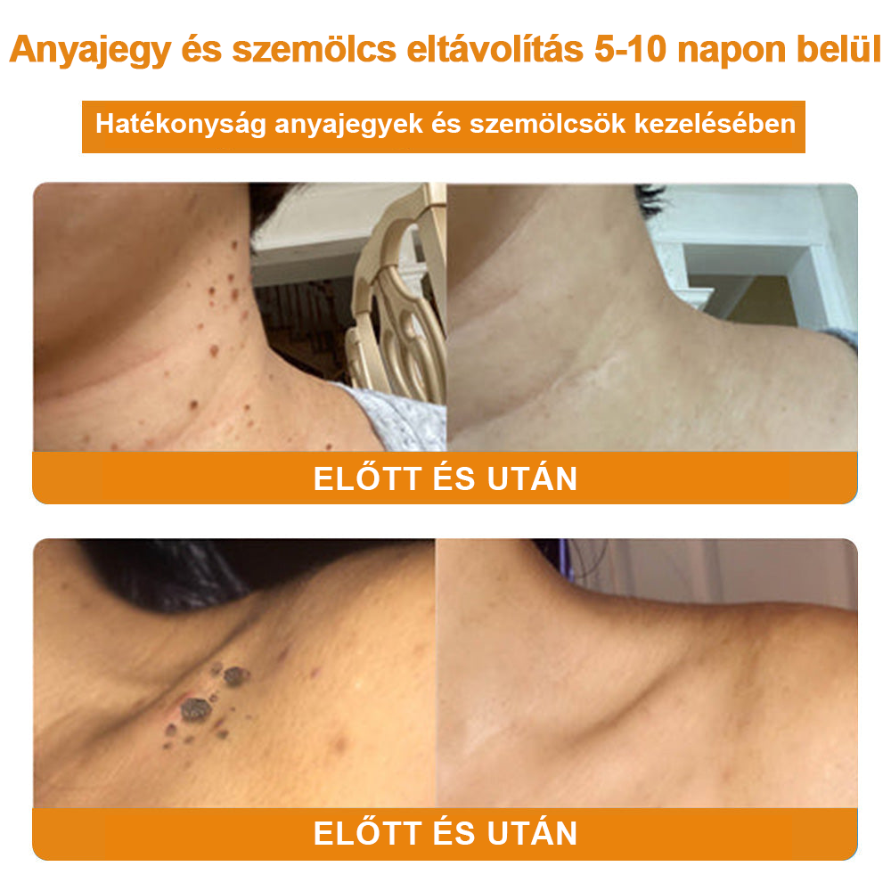 🎁 🍃🎁Már csak 5 doboz maradt! További 50% kedvezményt adunk! Tedd egészségesebbé a tested! Ha most lemaradsz róla, akkor csak jövőre kapod meg.