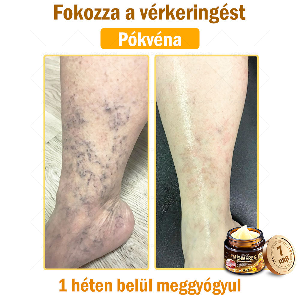 🔥🔥Már csak 5 doboz maradt! További 50% kedvezményt adunk! Tedd egészségesebbé a tested! Ha most lemaradsz róla, akkor csak jövőre kapod meg-APKAPK