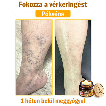 🔥🔥Már csak 5 doboz maradt! További 50% kedvezményt adunk! Tedd egészségesebbé a tested! Ha most lemaradsz róla, akkor csak jövőre kapod meg-APKAPK