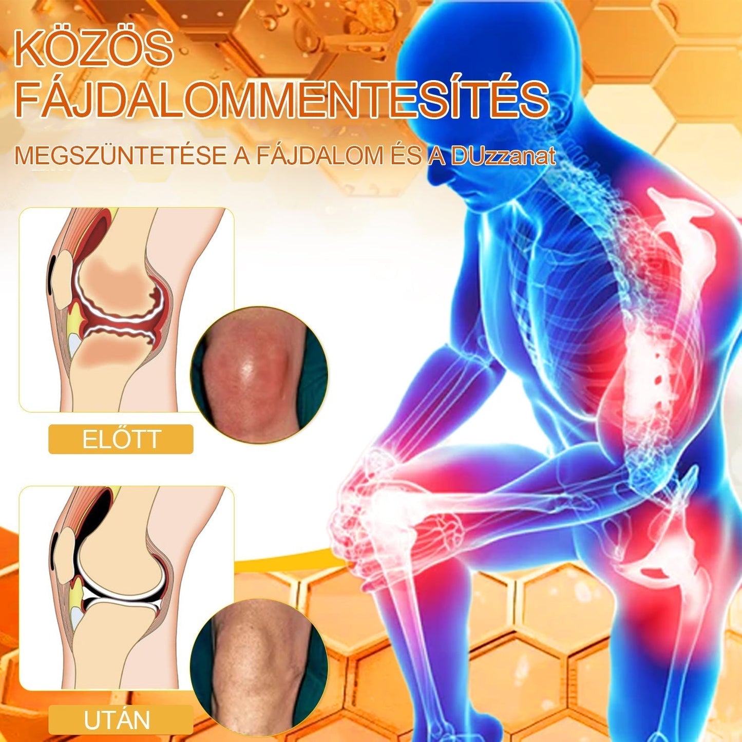 ZVLZVL™🍯Méhméreg Azonnali Ultra Erős Fájdalomcsillapító Krém -❄ Új téli akció | ❄ Akár 70% kedvezmény