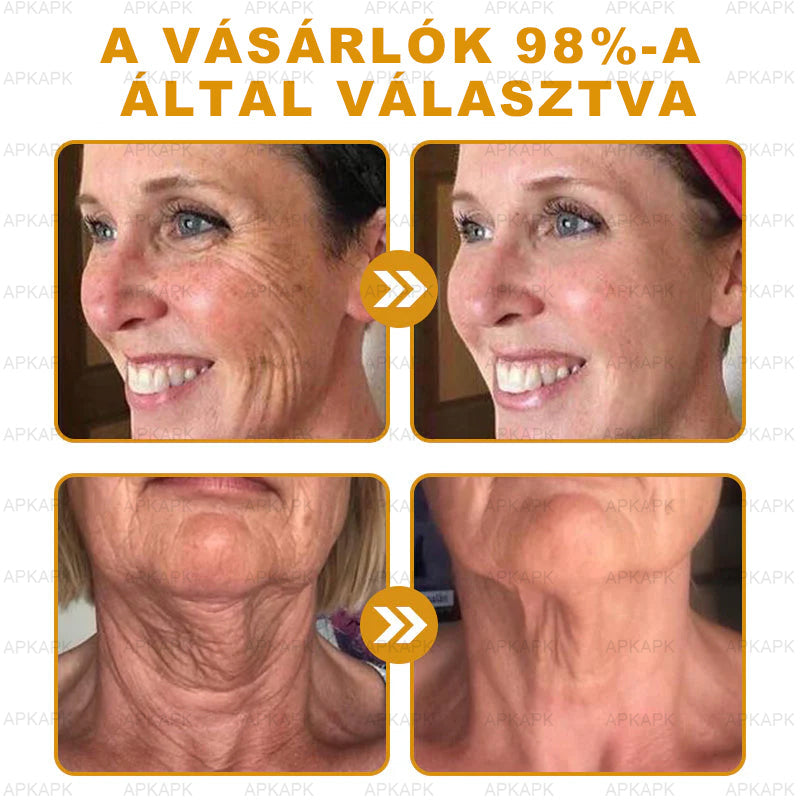 🔥🔥🔥𝐀𝐏𝐊𝐀𝐏𝐊™ 𝐌É𝐇𝐌É𝐑𝐄𝐆 Á𝐓𝐅𝐎𝐆Ó 𝐊𝐑É𝐌🥇𝐀 𝐛ö𝐫𝐩𝐫𝐨𝐛𝐥é𝐦á𝐤 𝐤𝐞𝐳𝐞𝐥é𝐬𝐞 𝐦𝐚𝐠á𝐛𝐚𝐧 𝐟𝐨𝐠𝐥𝐚𝐥𝐣𝐚: é𝐥𝐞𝐭𝐤𝐨𝐫𝐢 𝐟𝐨𝐥𝐭𝐨𝐤, 𝐡𝐞𝐠𝐞𝐤, 𝐬𝐳𝐞𝐦ö𝐥𝐜𝐬ö𝐤, 𝐛ö𝐫𝐧ö𝐯𝐞𝐝é𝐤𝐞𝐤, 𝐭á𝐥𝐲𝐨𝐠𝐨𝐤, 𝐩𝐚𝐭𝐭𝐚𝐧á𝐬𝐨𝐤, 𝐞𝐤𝐜é𝐦𝐚, 𝐩𝐬𝐨𝐫𝐢𝐚𝐬𝐢𝐬, 𝐚𝐜𝐧𝐞 𝐢𝐧𝐯𝐞𝐫𝐬𝐚, 𝐫á𝐧𝐜𝐨𝐤, 𝐛ö𝐫ö𝐫𝐞𝐠𝐞𝐝é𝐬 é𝐬 𝐞𝐠𝐲é𝐛 𝐩𝐫𝐨𝐛𝐥é𝐦á𝐤🔥