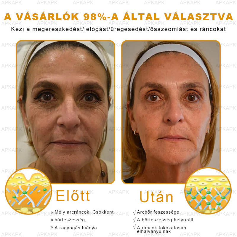 🔥🔥🔥𝐀𝐏𝐊𝐀𝐏𝐊™ 𝐌É𝐇𝐌É𝐑𝐄𝐆 Á𝐓𝐅𝐎𝐆Ó 𝐊𝐑É𝐌🥇𝐀 𝐛ö𝐫𝐩𝐫𝐨𝐛𝐥é𝐦á𝐤 𝐤𝐞𝐳𝐞𝐥é𝐬𝐞 𝐦𝐚𝐠á𝐛𝐚𝐧 𝐟𝐨𝐠𝐥𝐚𝐥𝐣𝐚: é𝐥𝐞𝐭𝐤𝐨𝐫𝐢 𝐟𝐨𝐥𝐭𝐨𝐤, 𝐡𝐞𝐠𝐞𝐤, 𝐬𝐳𝐞𝐦ö𝐥𝐜𝐬ö𝐤, 𝐛ö𝐫𝐧ö𝐯𝐞𝐝é𝐤𝐞𝐤, 𝐭á𝐥𝐲𝐨𝐠𝐨𝐤, 𝐩𝐚𝐭𝐭𝐚𝐧á𝐬𝐨𝐤, 𝐞𝐤𝐜é𝐦𝐚, 𝐩𝐬𝐨𝐫𝐢𝐚𝐬𝐢𝐬, 𝐚𝐜𝐧𝐞 𝐢𝐧𝐯𝐞𝐫𝐬𝐚, 𝐫á𝐧𝐜𝐨𝐤, 𝐛ö𝐫ö𝐫𝐞𝐠𝐞𝐝é𝐬 é𝐬 𝐞𝐠𝐲é𝐛 𝐩𝐫𝐨𝐛𝐥é𝐦á𝐤🔥