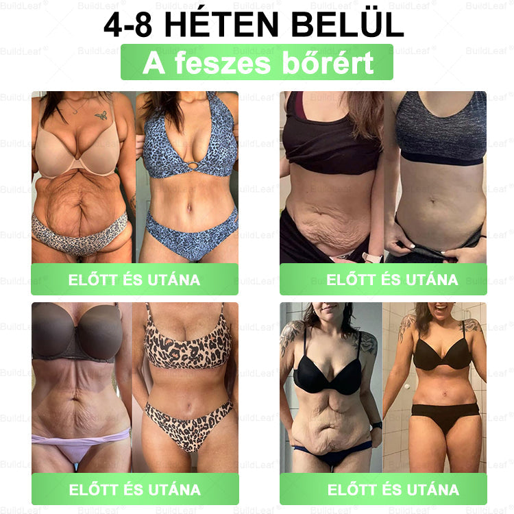 Karácsonyi limitált |BuildLeaf® GLP-1 8-az-1 Slim & Health szájüregi oldat – Egyszerű napi használat, látványos eredmény 7 nap alatt, 100 milliárd aktív probiotikummal ✅ testsúlykezelés, szív-, cukorbetegség-, bél- és női egészség, feszes bőr, energia.